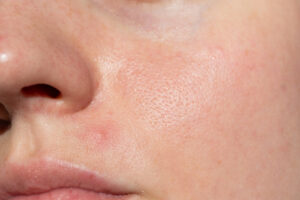 皮膚,オイリー,クローズアップ,人の肌,女性,女性一人,毛穴,