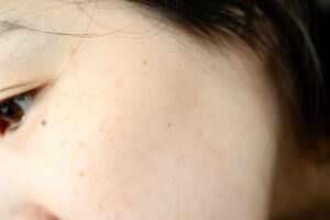 皮膚,オイリー,クローズアップ,人の肌,女性,女性一人,毛穴,